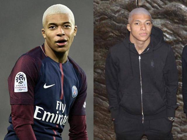 东体：蒯纪闻的伤势情况目前来看不至于像外界传得那么严重